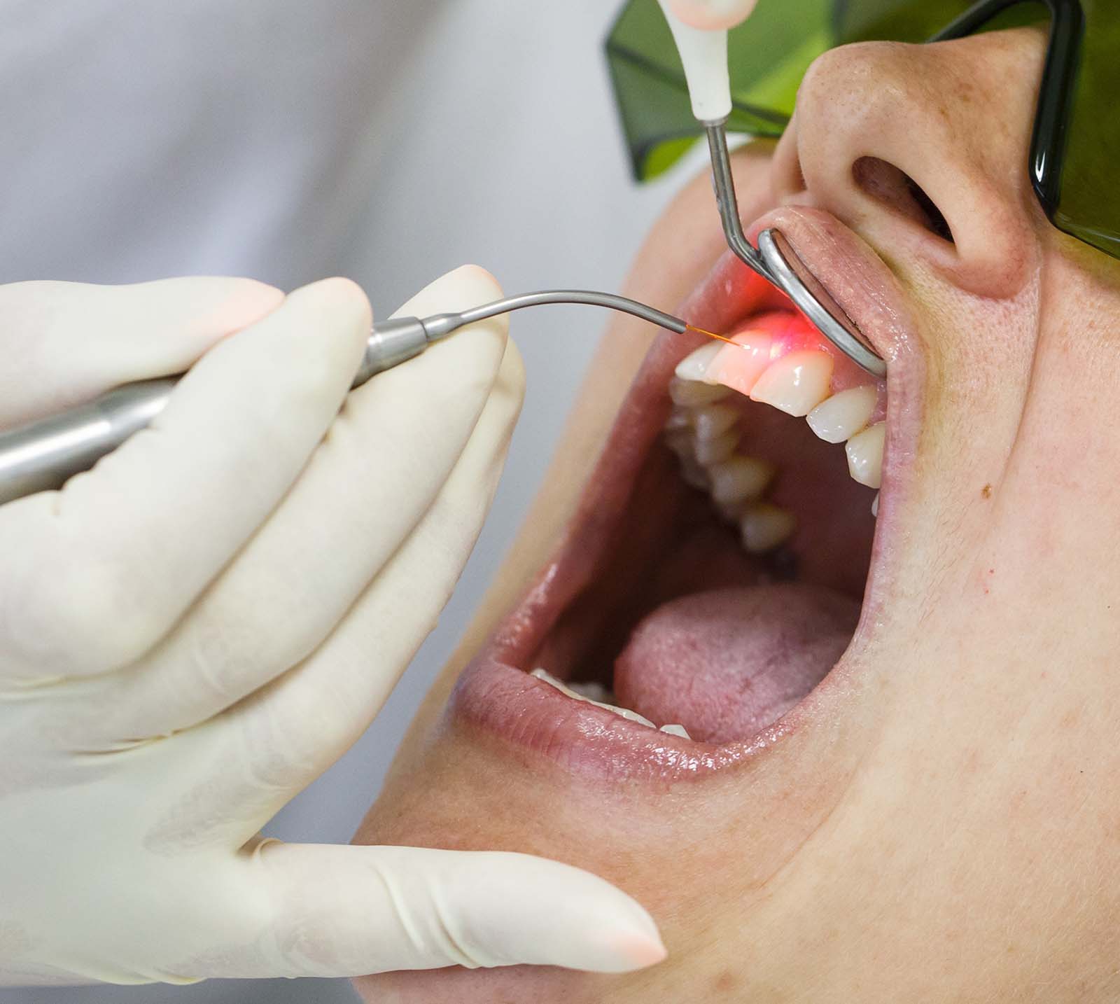 Periodontal Disease Treatment Vista