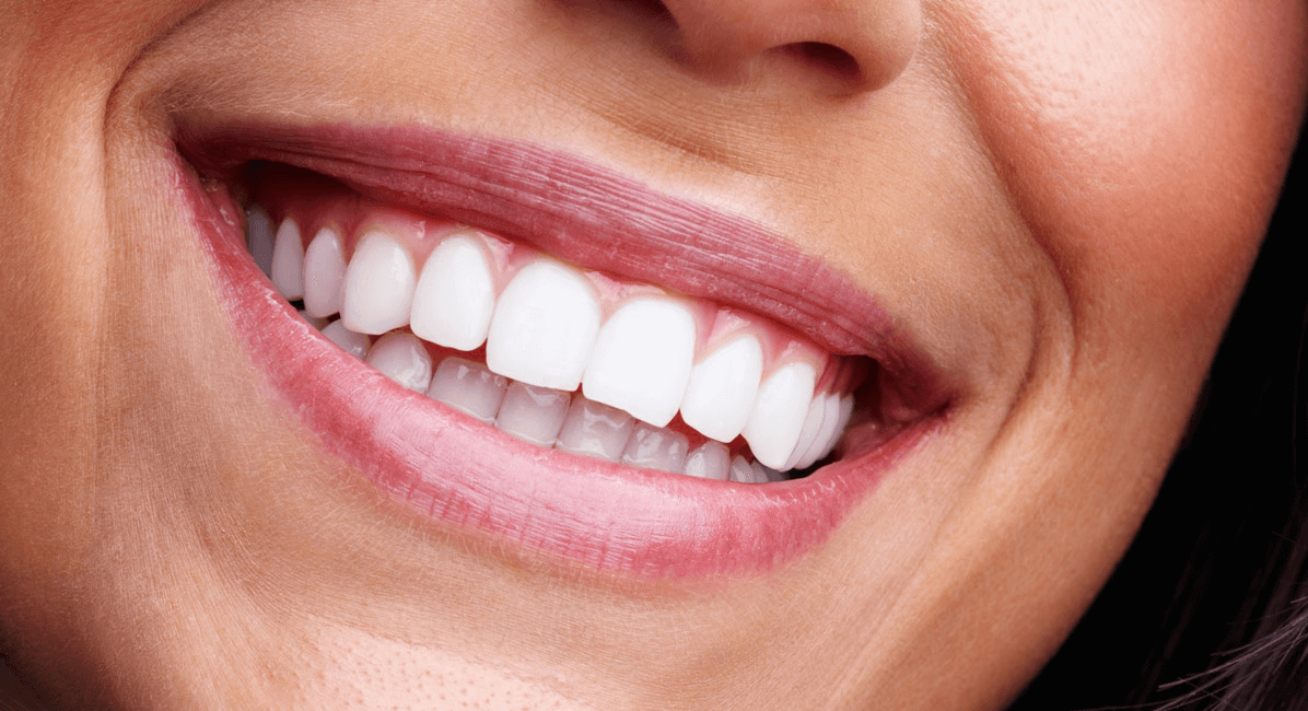 Full Mouth Reconstruction Dental Implants Encinitas